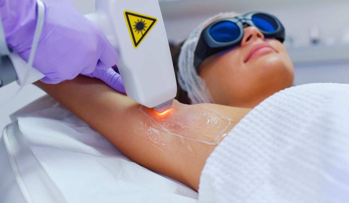 laser hair removal near me